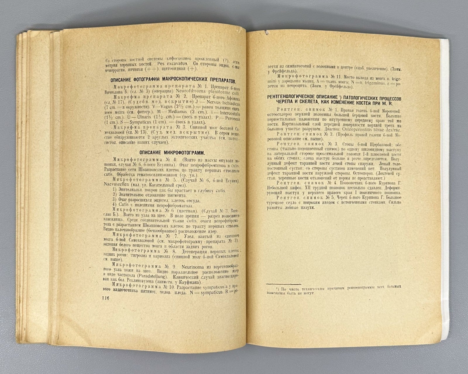 Recklinghausen Disease Medicine 1930 Злотников Болезнь Реклингаузена