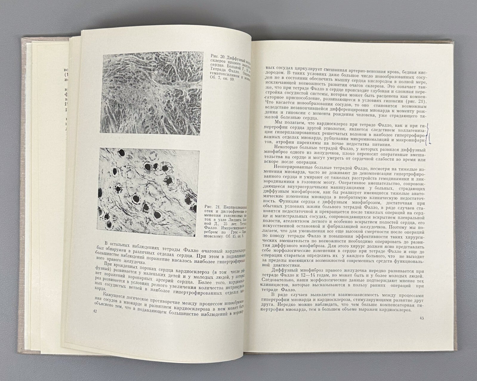 Autograph Vishnevsky Fallot's tetrad 1969 Вишневский Тетрада Фалло Монография