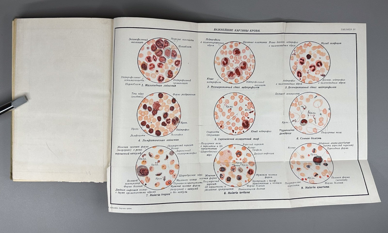Шиллинг Картина крови 1931 Schilling The Blood Picture Tropical Diseases Russian