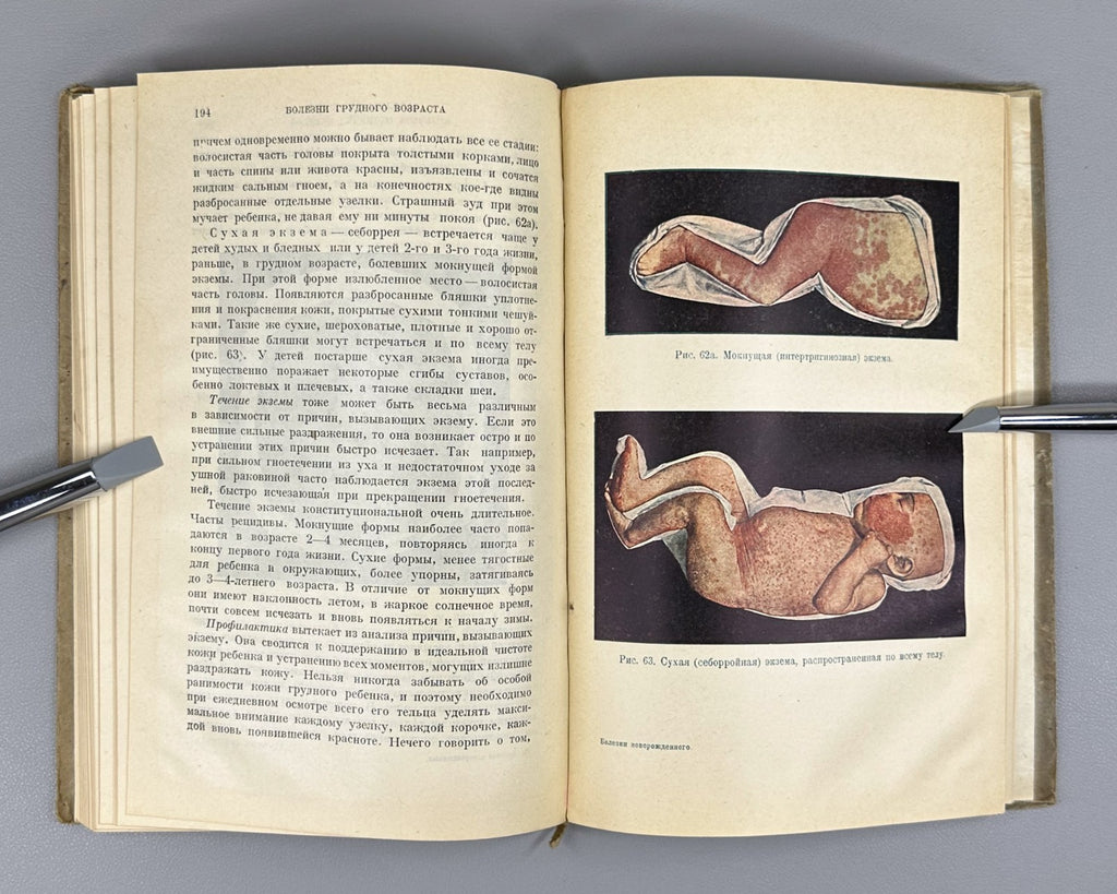 Болезни новорожденных Чеботаревская 1930 Diseases of Newborns and Infants Rus