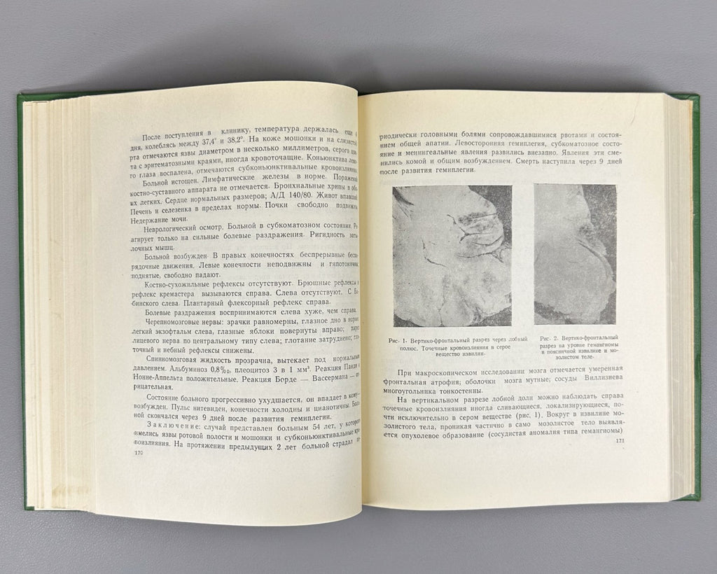Проблемы современной неврологии 1967 Problems of Contemporary Neurology Medical