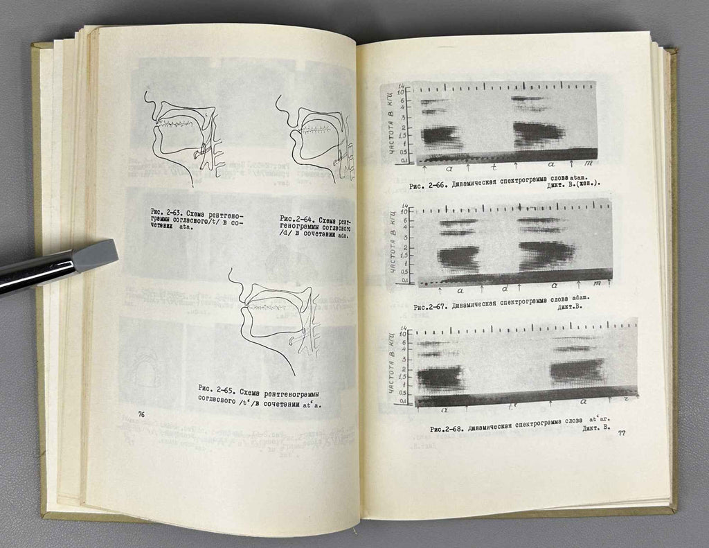 A. A. Khachatryan and V. N. Ayrapetyan. An Experimental Study of the Consonant Phonemes of Literary Armenian (Eksperimentalnoe issledovanie soglasnykh fonem literaturnogo armyanskogo yazyka). 1971. In Russian.